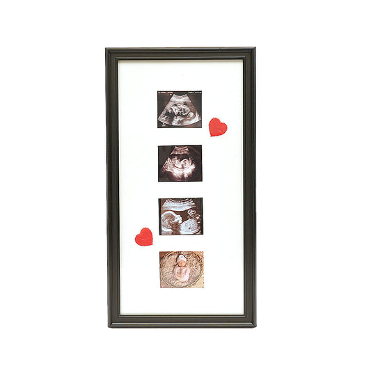 Custom Baby Photoframe